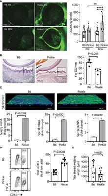 IL-17 Producing Lymphocytes Cause Dry Eye and Corneal Disease With Aging in RXRα Mutant Mouse